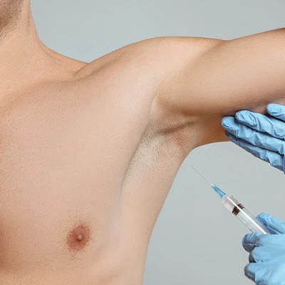 Leczenie nadpotliwości