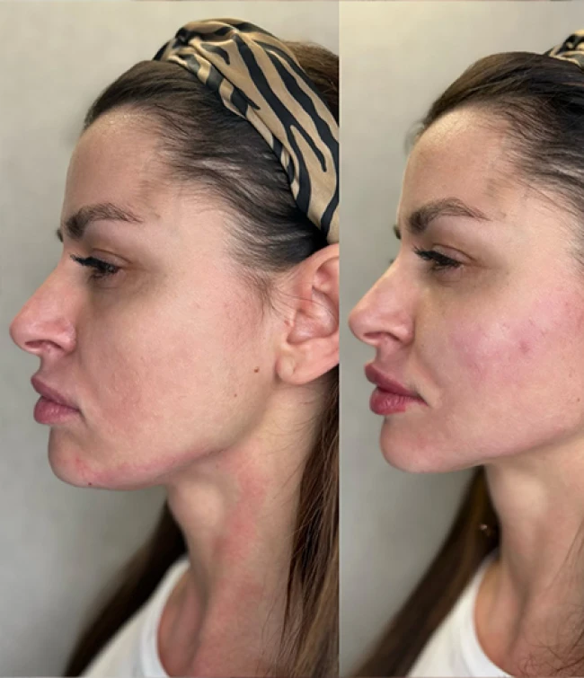 Zajęcia praktyczne w trakcie szkolenia z Hydroskapatytu wapnia